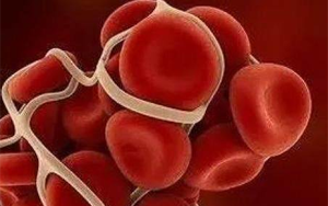 胃蛋白酶原II（PGII）-磁微粒化學(xué)發(fā)光法（AE/AP）/熒光免疫層析解決方案（含保護(hù)劑評估）