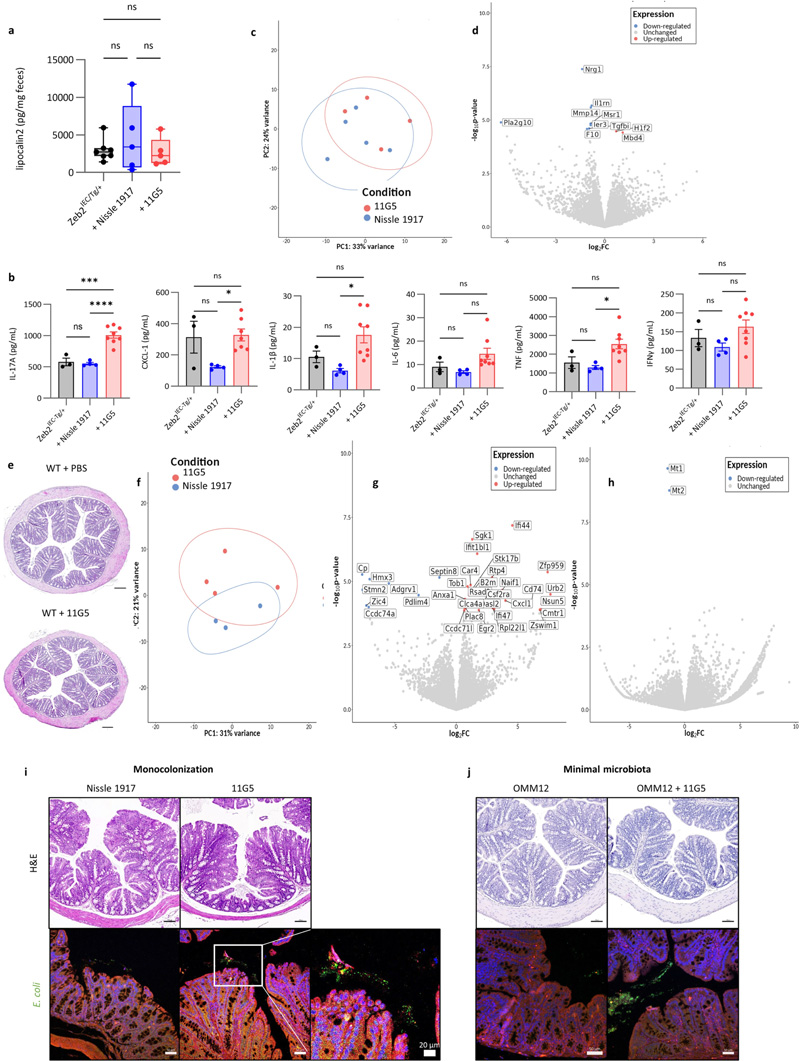 
大腸桿菌11G5感染不會(huì)增加Zeb2 IEC-Tg/+小鼠的結(jié)腸炎癥，也不會(huì)影響WT同窩小鼠的上皮細(xì)胞
