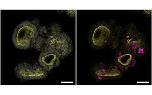 Cell：突破類(lèi)器官研究限制！利用所有關(guān)鍵的胰腺細(xì)胞創(chuàng)造了一個(gè)新的類(lèi)器官