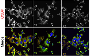 《Nature》細(xì)胞的應(yīng)激反應(yīng)比科學(xué)家認(rèn)為的更細(xì)微、更分散
