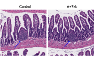 Nature：科學(xué)家新發(fā)現(xiàn)一種免疫細(xì)胞類型，與過(guò)敏有關(guān)