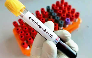 血漿凝血酶-抗凝血酶復(fù)合物（TAT）- 磁微粒化學(xué)發(fā)光法