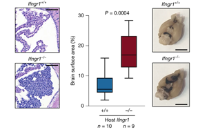 干擾素 -γ（IFNγ）調(diào)控軟腦膜抗腫瘤免疫應(yīng)答的機(jī)制研究