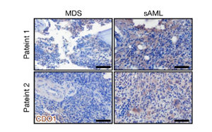Nature：?；撬崮芡苿?dòng)白血病癌細(xì)胞生長(zhǎng)！