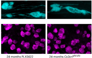 《Nature Neuroscience》大腦白質(zhì)為何隨年齡退化？因?yàn)槊庖呒?xì)胞“勾心斗角”