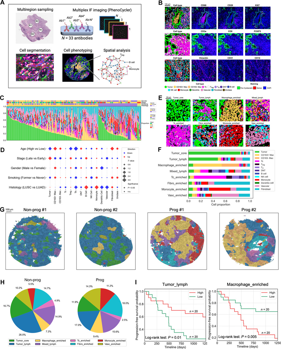  基于多重免疫熒光成像（mIF）的非小細(xì)胞肺癌組織微環(huán)境表征