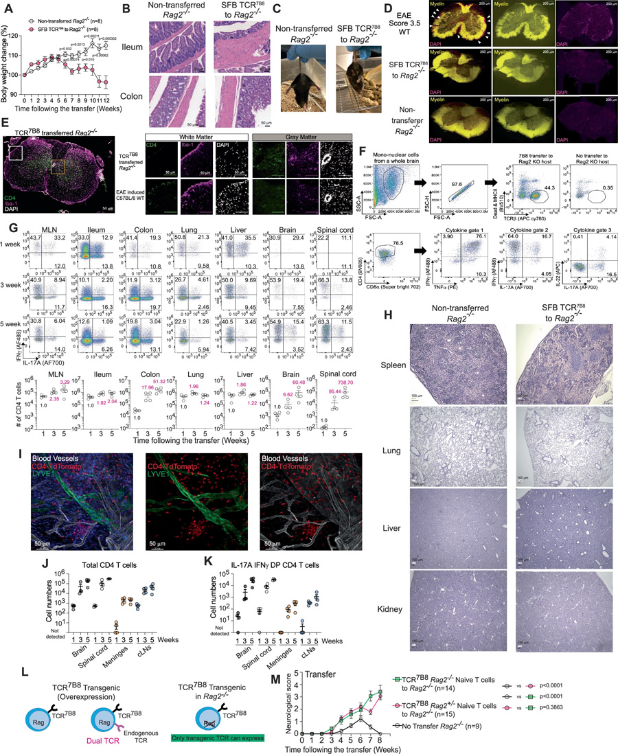  轉(zhuǎn)移的TCR7B8 CD4 T細胞在腸道和中樞神經(jīng)系統(tǒng)中擴增并展現(xiàn)致病活性