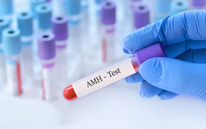 抗繆勒管激素（AMH）-磁微?；瘜W(xué)發(fā)光法（AE/AP） +熒光免疫層析解決方案