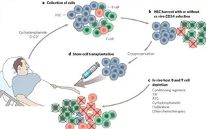 自體造血干細胞移植時S期殘留克隆性漿細胞對多發(fā)性骨髓瘤臨床預后的影響研究