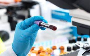 【FAPGG】，血管緊張素轉(zhuǎn)換酶檢測(cè)用底物