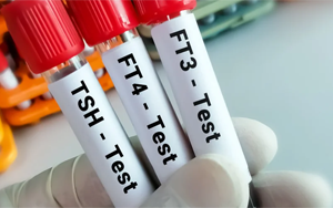 總及游離甲狀腺素（TT4及FT4）-磁微粒化學發(fā)光法（AE/AP）解決方案（雙抗體夾心法）