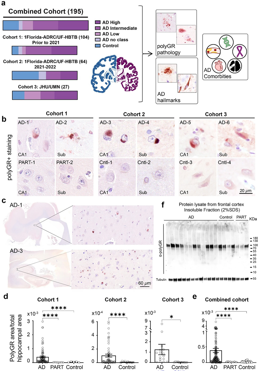 在多組阿爾茨海默病尸檢腦樣本中，海馬體頻繁檢測(cè)到PolyGR+?蛋白聚集物