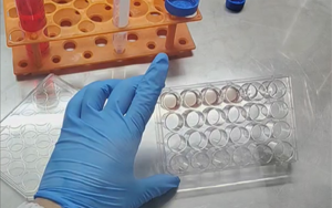 精準營養(yǎng)，塑造未來：類器官培養(yǎng)基的新紀元