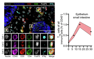 組織適應性Treg細胞通過整合炎癥信號（IFN-γ/IL-10）激活mTORC1/Myc通路促進治療相關腸道損傷修復的新機制