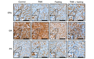 禁食通過激活糖皮質(zhì)激素來提高乳腺癌治療的療效