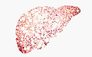 Cell：高脂飲食迫使肝細胞自保，卻最終誘發(fā)肝癌