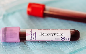 同型半胱氨酸（HCY）-磁微?；瘜W(xué)發(fā)光法（AE/AP） +熒光免疫層析解決方案