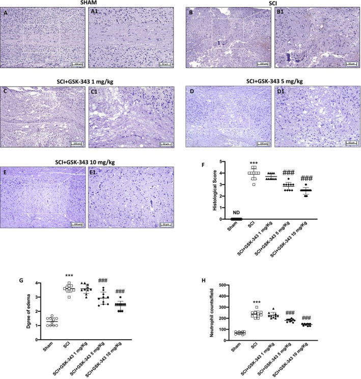 GSK治療改善了脊髓組織損傷 GSK治療改善了脊髓組織損傷