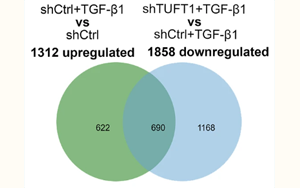 TUFT1通過穩(wěn)定TβRII蛋白促進肝星狀細(xì)胞活化為促轉(zhuǎn)移肌成纖維細(xì)胞的新機制及其在結(jié)直腸癌肝轉(zhuǎn)移中的作用