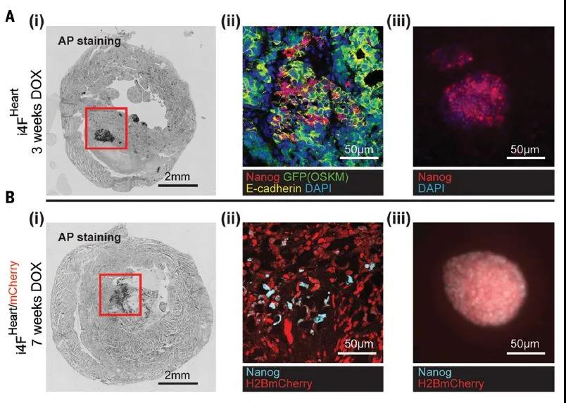 Science重磅：局部重編程讓心肌細(xì)胞“返老還童” 讓心臟實(shí)現(xiàn)再生！