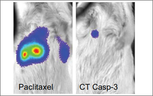Nature子刊：用細(xì)菌遞送藥物到癌細(xì)胞內(nèi)，有效治療肝癌和乳腺癌