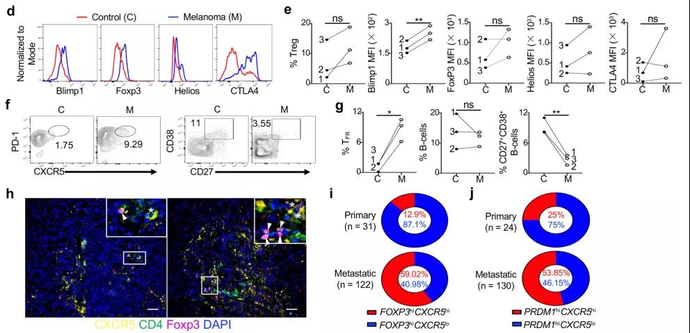 如何重塑腫瘤微環(huán)境，強化抗PD-1療效？Treg細(xì)胞的Blimp1表達是關(guān)鍵！