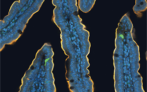 喝完無糖飲料還想吃甜食？人們對糖的渴望，無法被甜味劑替代，答案都在腸道里！