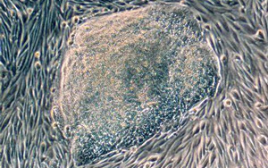 首次發(fā)現(xiàn)人類尿液來源的干細胞具有強大的再生潛力！