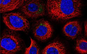 《PNAS》認(rèn)識(shí)溶酶體的知識(shí)又增加了