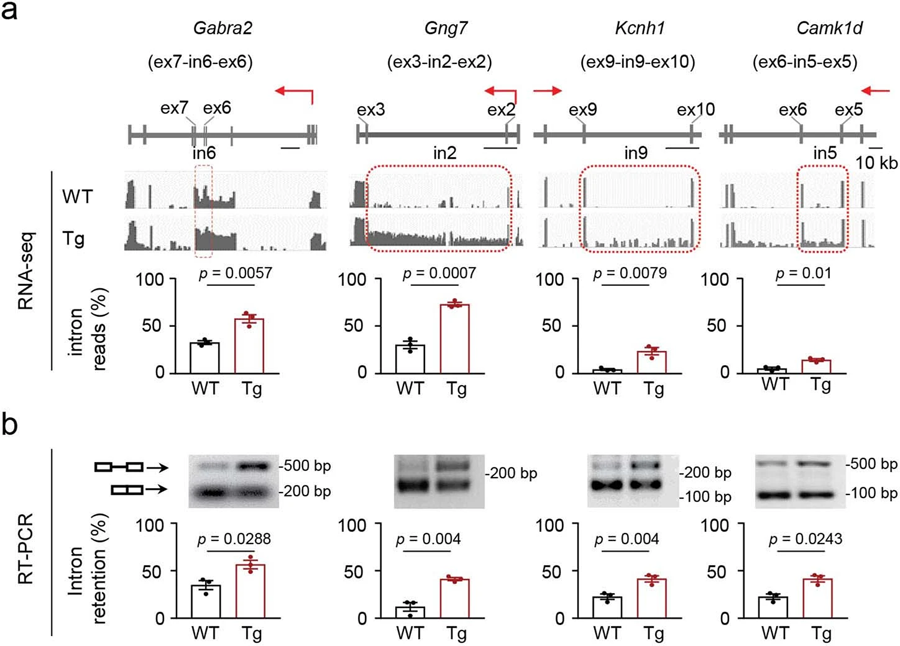 N40K-Tg小鼠突觸通路剪接缺陷轉(zhuǎn)錄的驗(yàn)證
