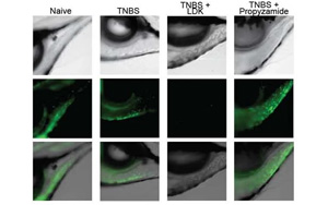 環(huán)境中的化學(xué)物質(zhì)會增加炎癥性腸病的風(fēng)險