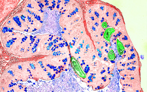 Nature新研究解答爭(zhēng)議，為炎癥性疾病的免疫機(jī)制提供新見解
