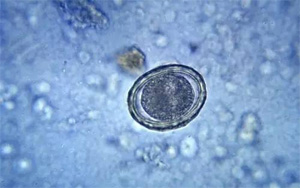 讓培養(yǎng)皿“患上”PTSD，然后為人類拓寬治療手段