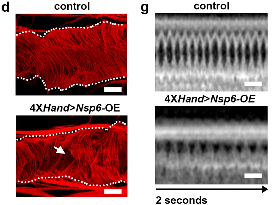 UAS-SARS-CoV-2Nsp6轉(zhuǎn)基因的4XH和Gal4、成纖維細(xì)胞特異性過(guò)表達(dá)（OE）誘導(dǎo)的成人心臟表型
