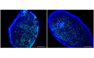 Nature：恢復(fù)活力的免疫細(xì)胞能更好地清除大腦中的有毒廢物
