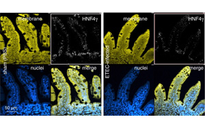 某些形式的兒童營養(yǎng)不良和發(fā)育遲緩可以通過疫苗預防
