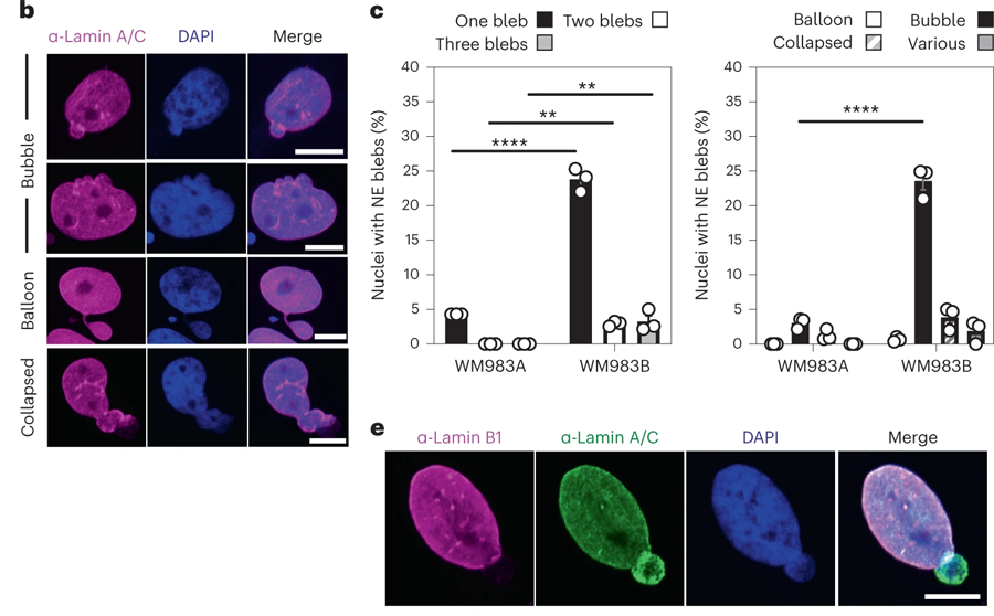 轉(zhuǎn)移性黑色素瘤細胞的NE(核包膜蛋白）是高度活躍的