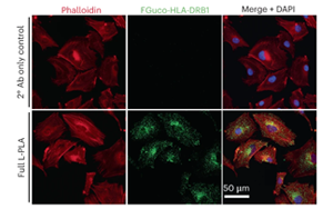 食用L-巖藻糖來(lái)對(duì)抗黑色素瘤