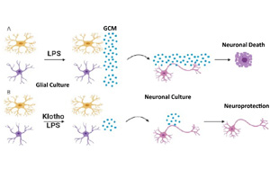 26年前發(fā)現(xiàn)的抗衰老蛋白可以對(duì)抗炎癥，避免神經(jīng)元死亡
