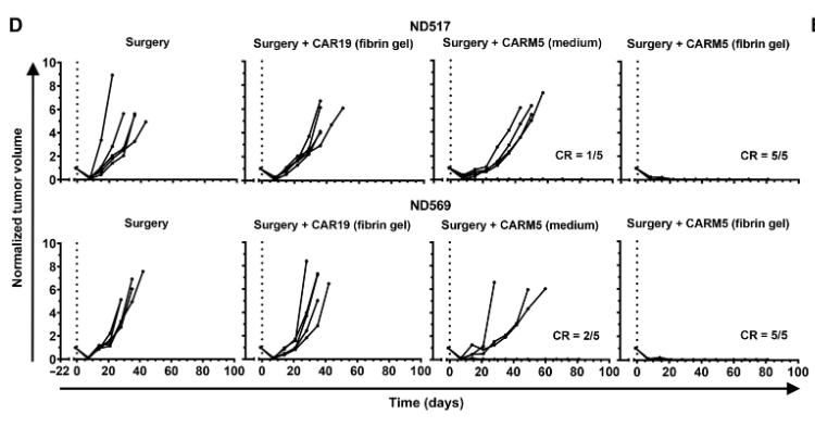 纖維蛋白凝膠中的CAR-T細胞在TNBC異種移植模型中有效清除術(shù)后殘留腫瘤細胞