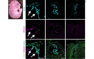 《Nature》淋巴系統(tǒng)潛在的新功能——造血！