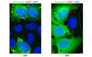 肺細胞如何保護自己免受RNA病毒感染？