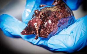 神經(jīng)信號調(diào)節(jié)新發(fā)現(xiàn)：L-或D-氨基酸？鏡像分子可改變神經(jīng)元的信號！