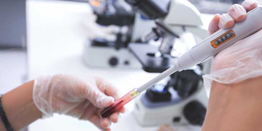 肌紅蛋白（MYO）檢測