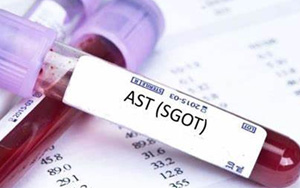 谷草轉(zhuǎn)氨酶（AST/GOT）檢測試劑盒用原輔料