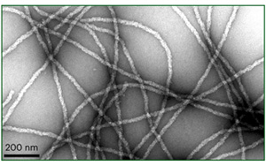 一個高度不穩(wěn)定的蛋白質導致神經(jīng)退化