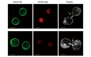 是什么決定了CD8+ T細胞的命運？Immunity新研究指向cBAF復合物