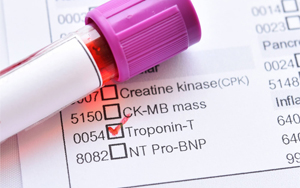 心肌肌鈣蛋白T（cTnT）-磁微粒化學(xué)發(fā)光法（吖啶酯） /熒光免疫層析解決方案