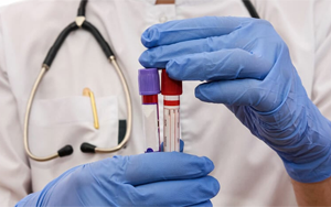 肌酸激酶同工酶（CK-MB）-磁微粒化學(xué)法學(xué)發(fā)光（AE/AP） /熒光免疫層析解決方案