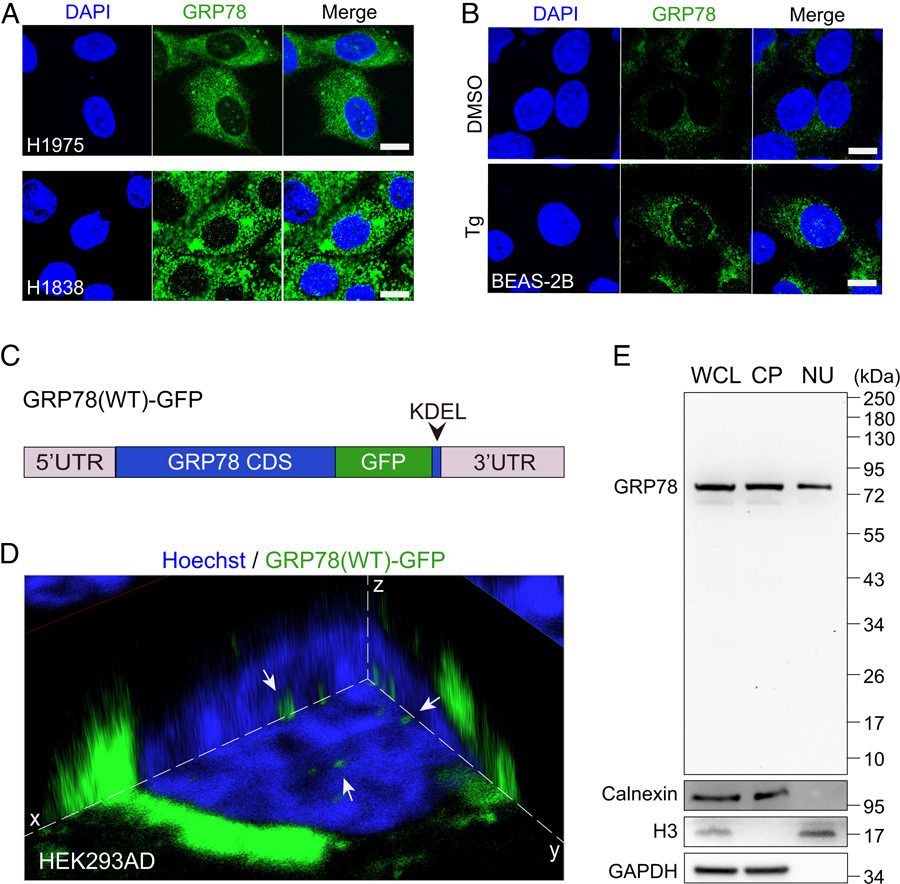 GRP78定位于人癌癥細(xì)胞和內(nèi)質(zhì)網(wǎng)應(yīng)激細(xì)胞的細(xì)胞核。